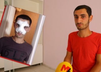 تركيا.. اعتداء عنصري على جندي تحدث باللغة الكردية!