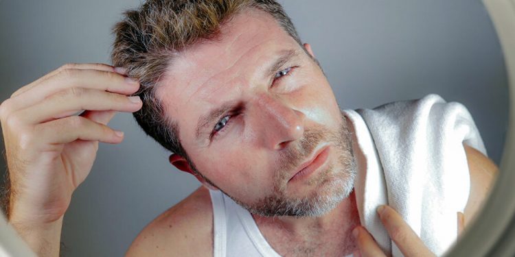 هل نستطيع إخفاء الشيب طبيعيًا؟