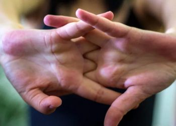 ما الذي يسببه “فرقعة” الأصابع؟