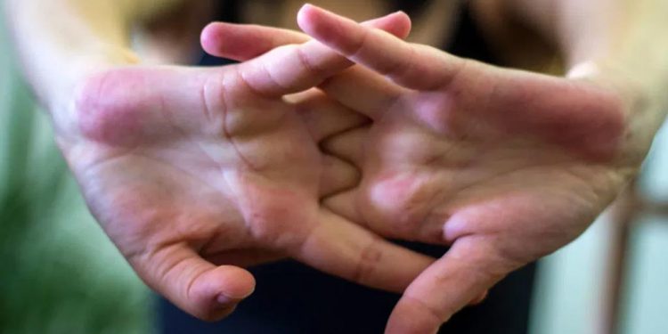 ما الذي يسببه “فرقعة” الأصابع؟