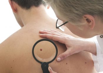أسباب وعلاج حبوب الظهر