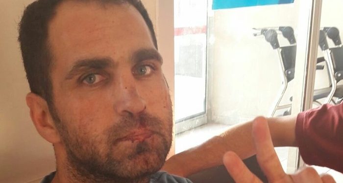 اعتداء على معتقلين بسجن بولو في تركيا باللكمات والركلات