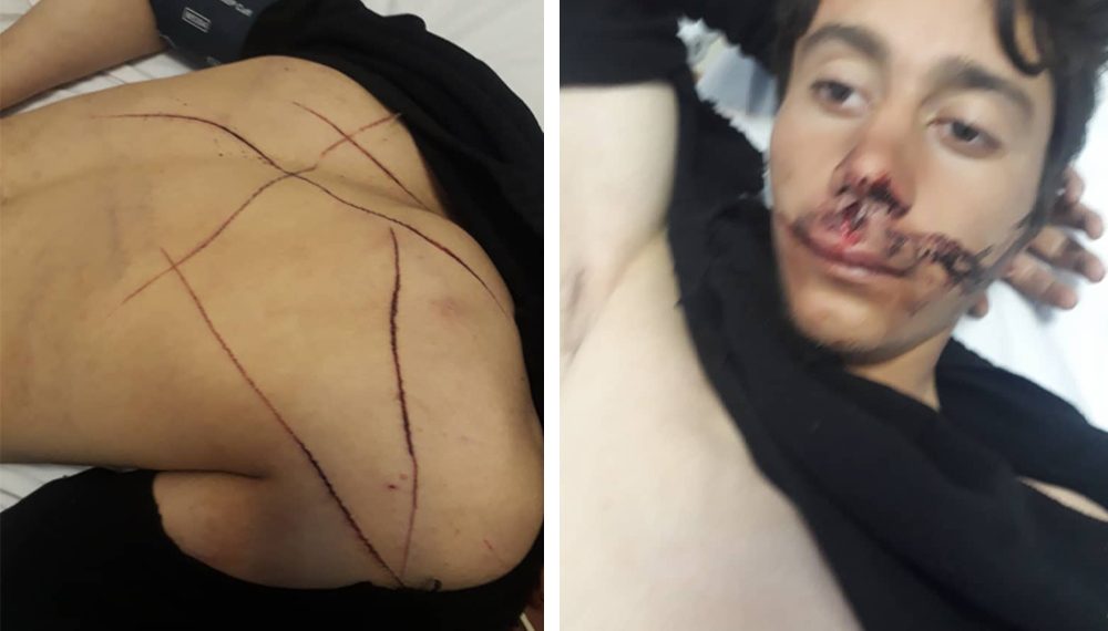 تركيا.. أنباء عن تعذيب إيراني ووفاة آخر بمركز شرطة