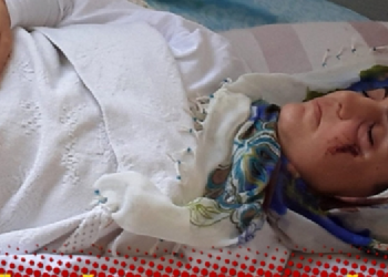 تركيا.. مريضة سرطان تتغذى عبر الأنف تواجه خطر السجن! 