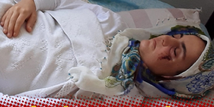 تركيا.. مريضة سرطان تتغذى عبر الأنف تواجه خطر السجن!