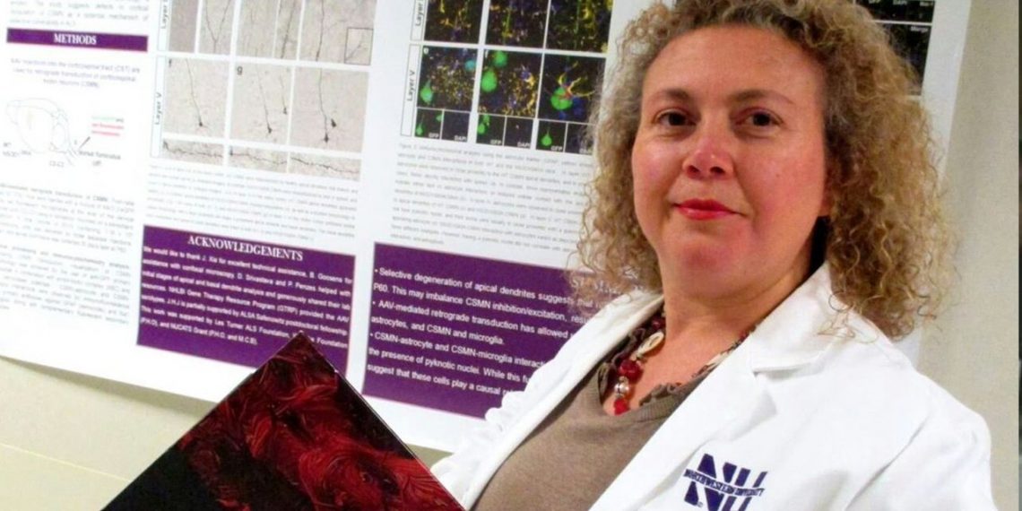 عالمة تركية تتوصل لعلاج يعيد إحياء خلايا المخ الميتة