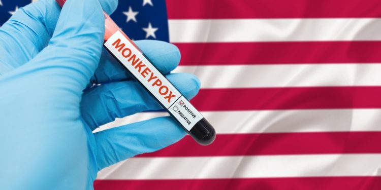 رسميًّا.. أمريكا تعلن “جدري القرود”  طوارئ صحيّة في البلاد