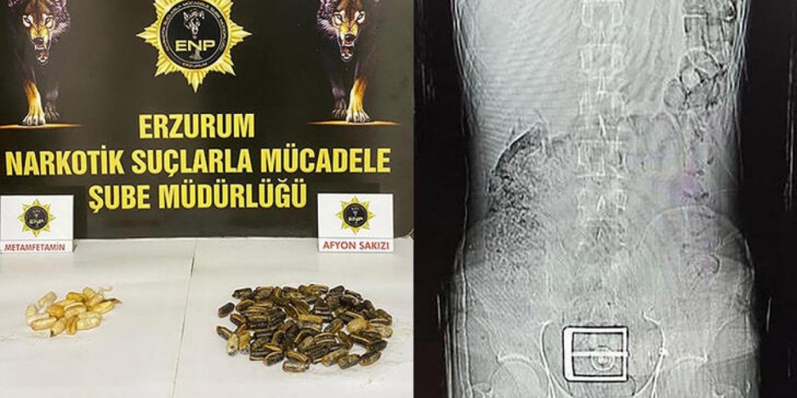 تركيا .. إيراني يخفي 95 كبسولة مخدرات في معدته