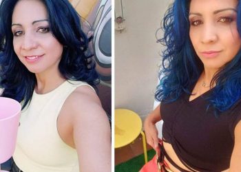 وفاة إسبانية في إسطنبول بعد عملية تجميل