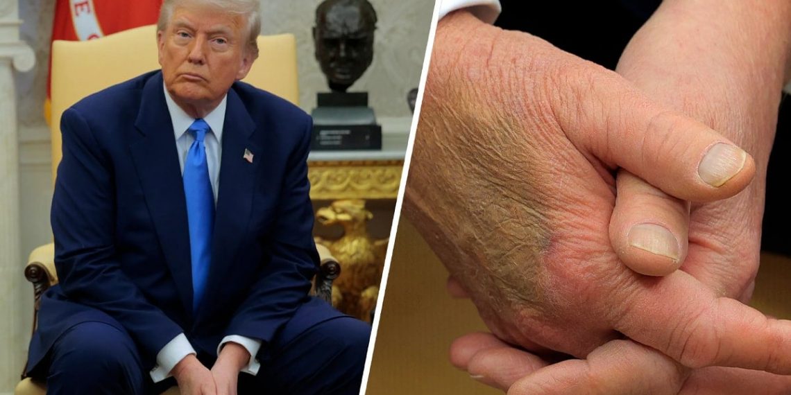 أنباء عن نقل ترامب إلى المستشفى العسكري تثير جدلا